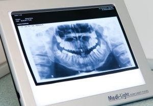 Radiologie Dentara